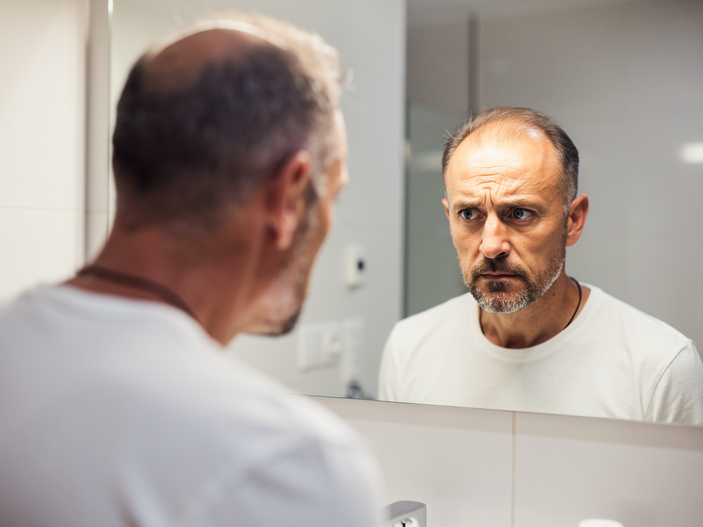 Saw Palmetto as Finasteride Alternative: Does It Block DHT Without Sexual Side Effects?